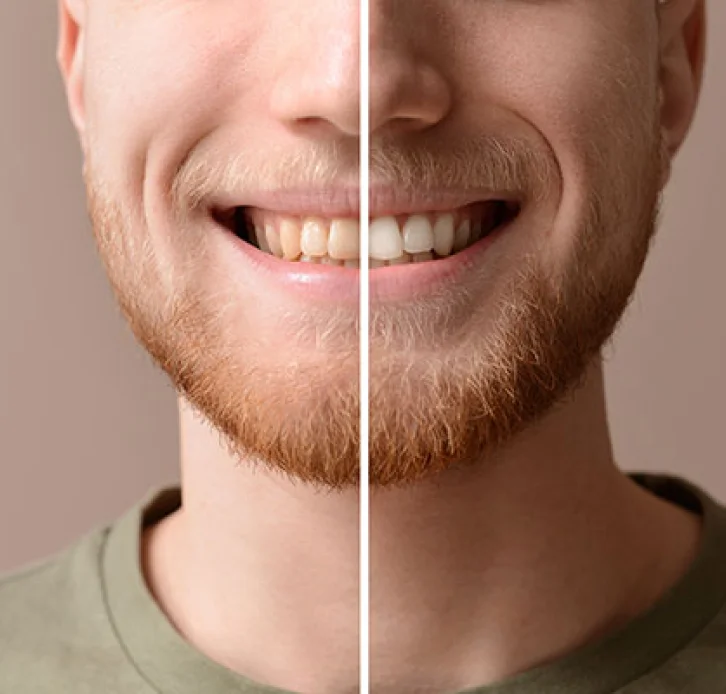 Dental Patient Smiling