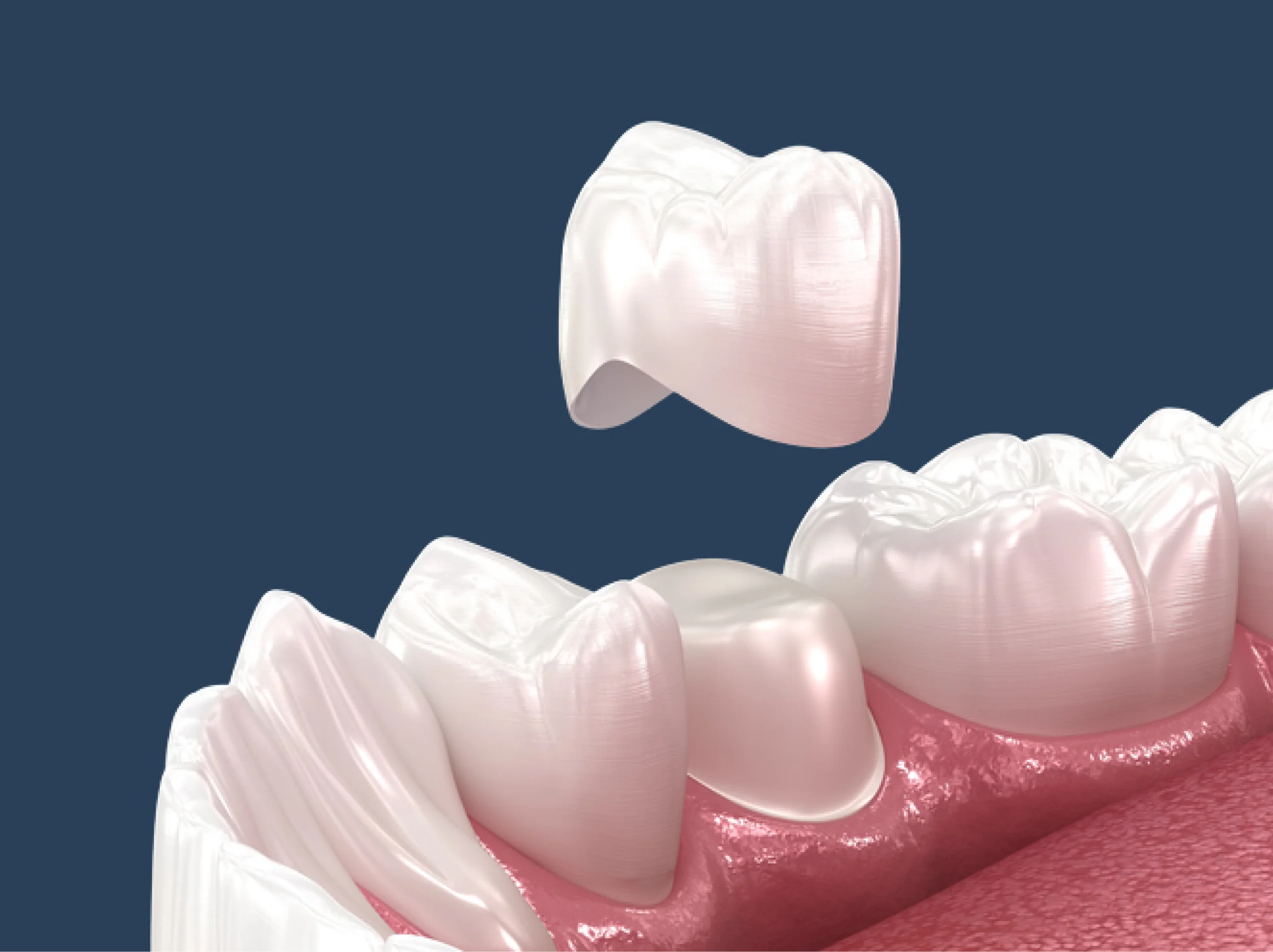 Background dental image