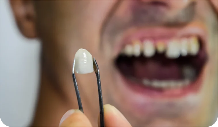 Happy patient pointing to smile