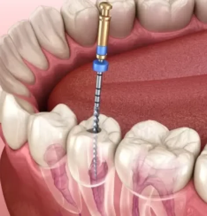 Dental Patient Smiling