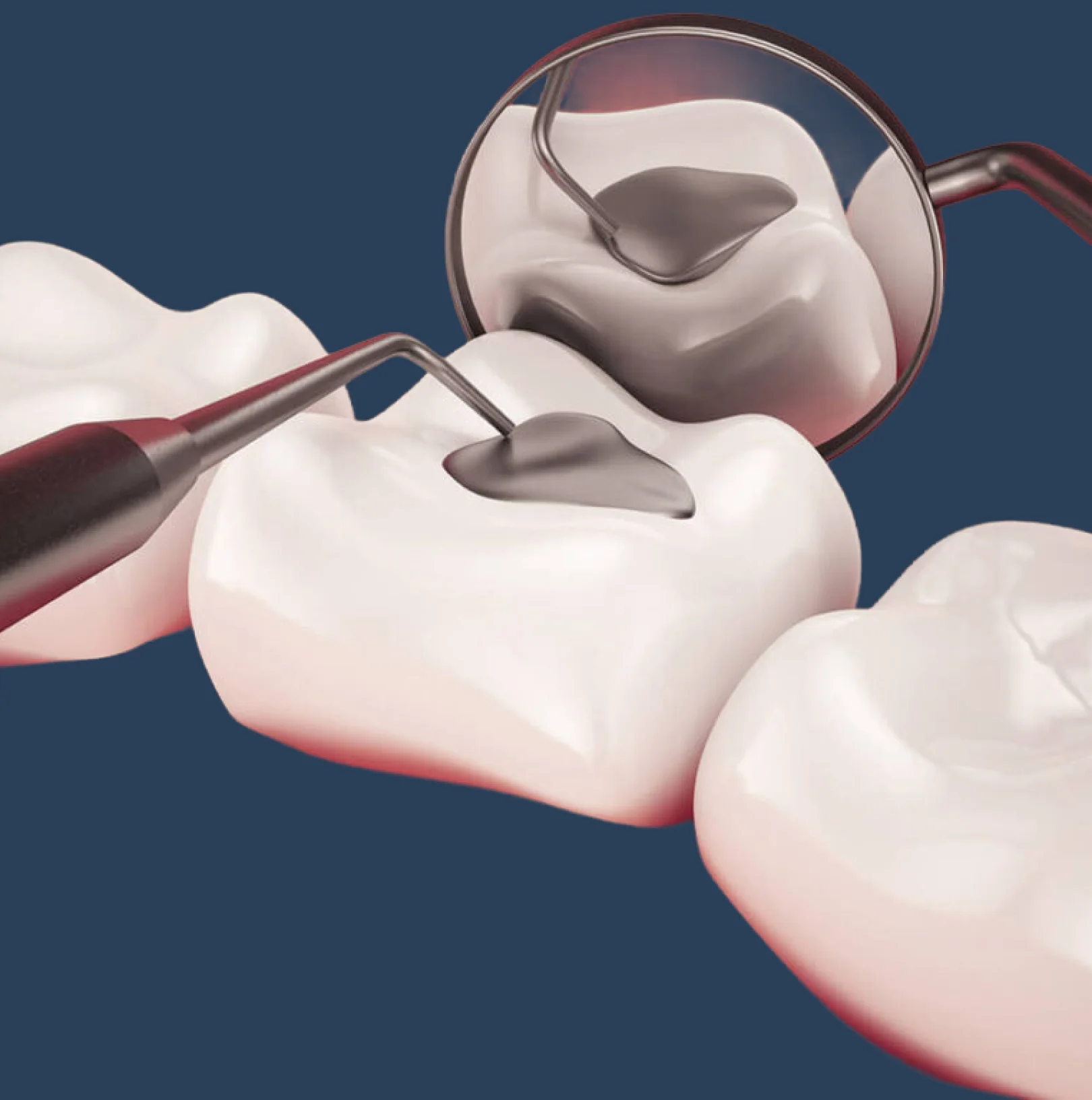 Background dental image