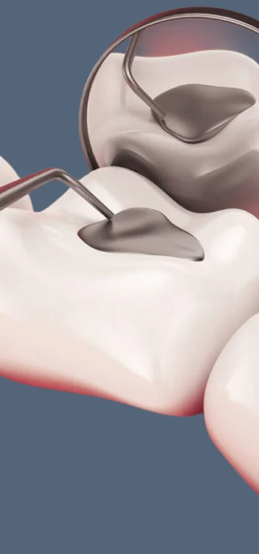 Background dental image