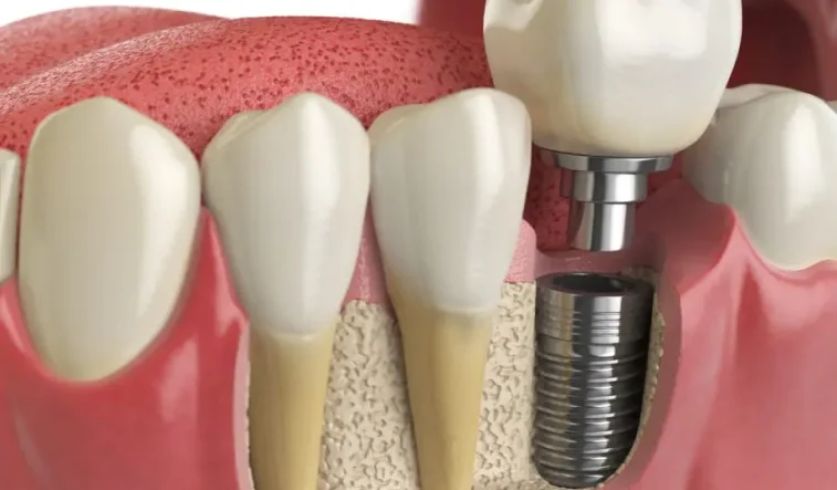 Happy patient pointing to smile