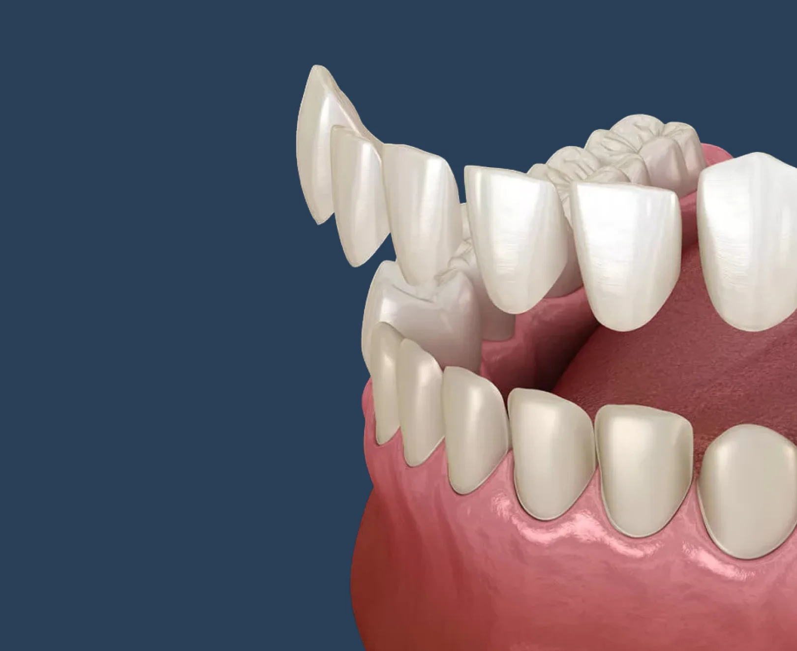 Background dental image