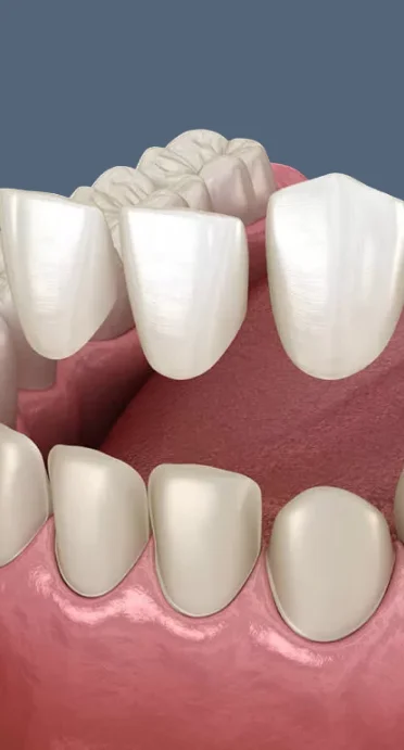 Background dental image