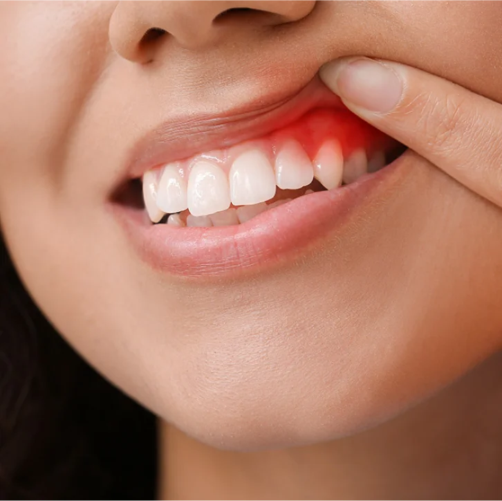 Dental Patient Smiling